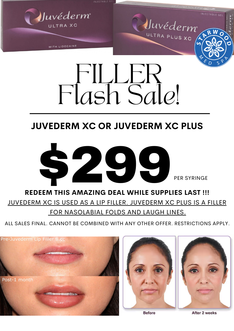 FILLER FLASH SALE – Starwood Med Spa